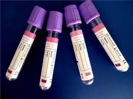 Blood Test HLA Antigens 2ml lavender EDTA